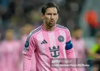 Messi bị chế giễu đầu hói, răng sún